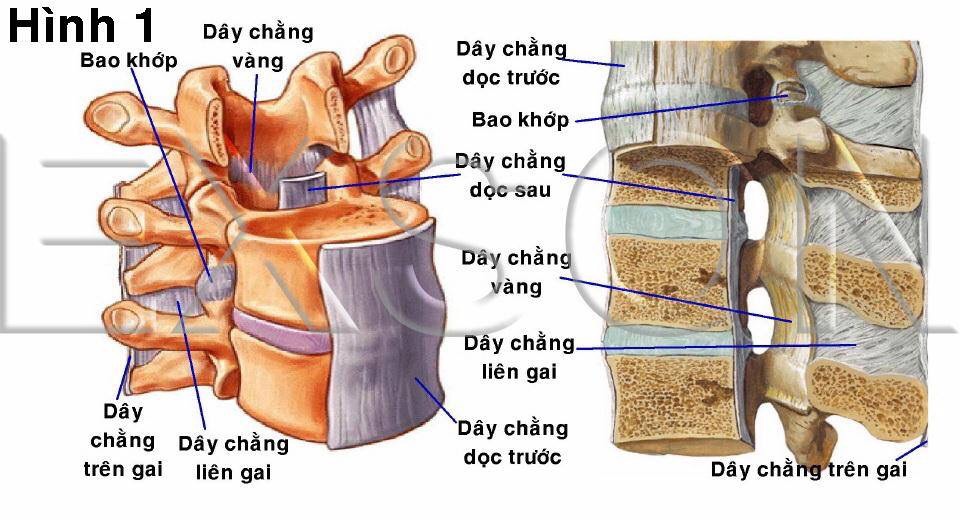 NHỒI MÁU TỦY SỐNG